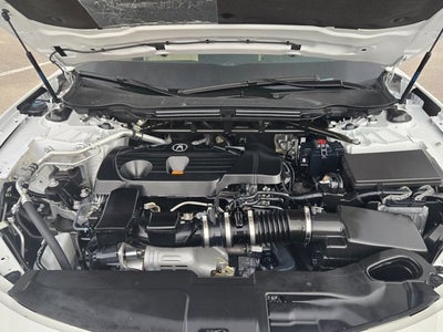 2025 Acura TLX FWD with Technology Package